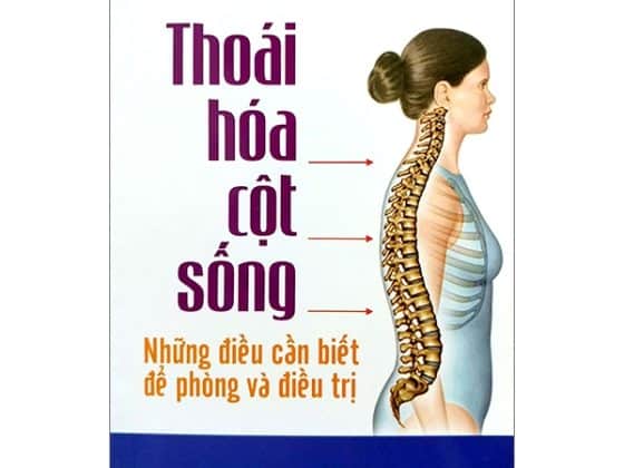 Thoái Hóa Cột Sống - Những Điều Cần Biết Và Điều Trị PDF